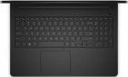 Ноутбук Dell Inspiron 5559 (I557810DDW-T2S) Black - фото 3 - інтернет-магазин електроніки та побутової техніки TTT