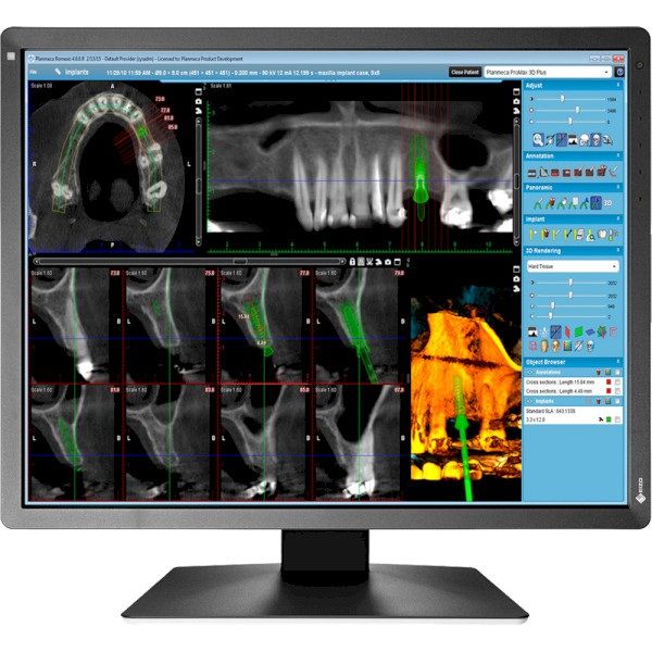 

Монітор EIZO RadiForce MX216 (MX216-SB) Black